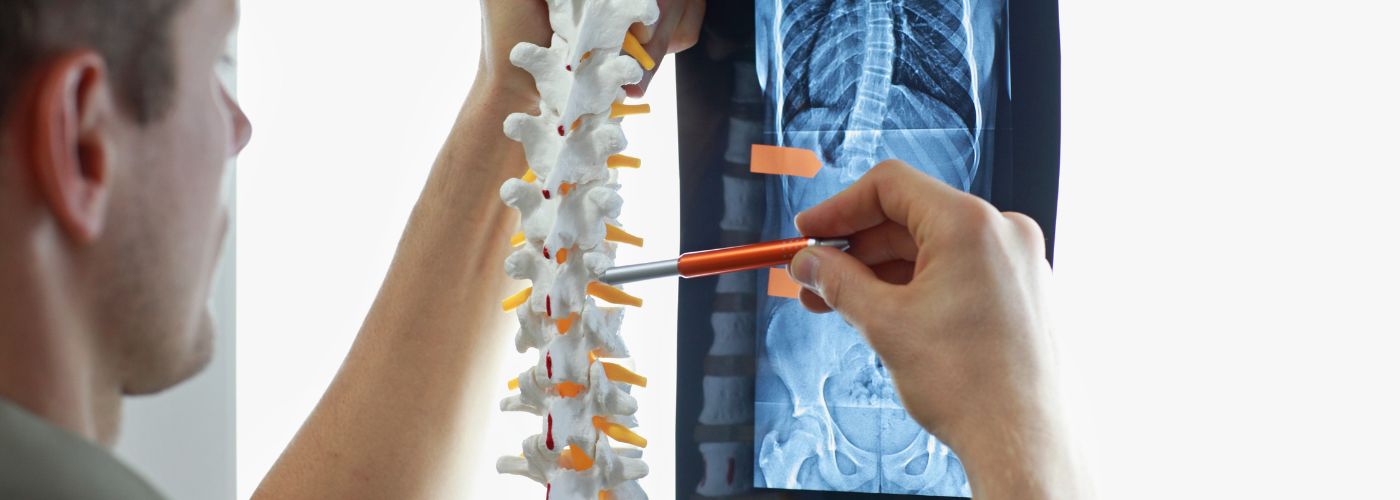 What is a Spinal Injury?